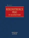 Rekonstrukce prsu po mastektomii - Jan Měšťák, Luboš Dražan - e-kniha