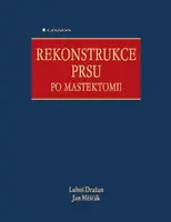 Rekonstrukce prsu po mastektomii - Jan Měšťák, Luboš Dražan - e-kniha