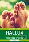 Hallux (Řešení bez operace) - Carsten Stark
