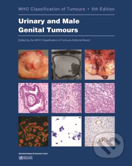 Urinary and Male Genital Tumours (Who Classification of Tumours (5th Edition, Volume 8)) - kniha z kategorie Medicína