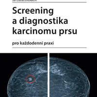 Kniha: Screening a diagnostika karcinomu prsu od Daneš Jan