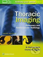 Thoracic Imaging (Pulmonary and Cardiovascular Radiology) - kniha z kategorie Medicína