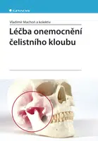 E-kniha: Léčba onemocnění čelistního kloubu od Machoň Vladimír