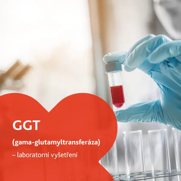 Gama-glutamyltransferáza (GGT) - laboratorní vyšetření