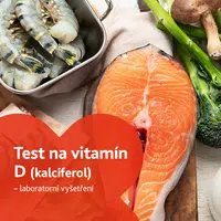Test na vitamín D (kalciferol) - laboratorní vyšetření