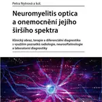 Neuromyelitis optica a poruchy jejího širšího spektra - kniha z kategorie Medicína