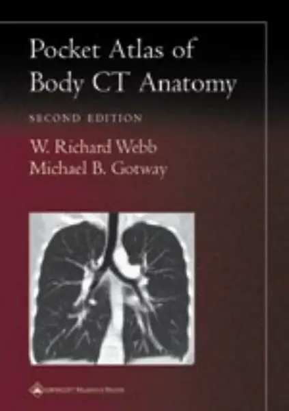 Pocket Atlas of Body CT Anatomy - Michael B. Gotway, W. Richard Webb
