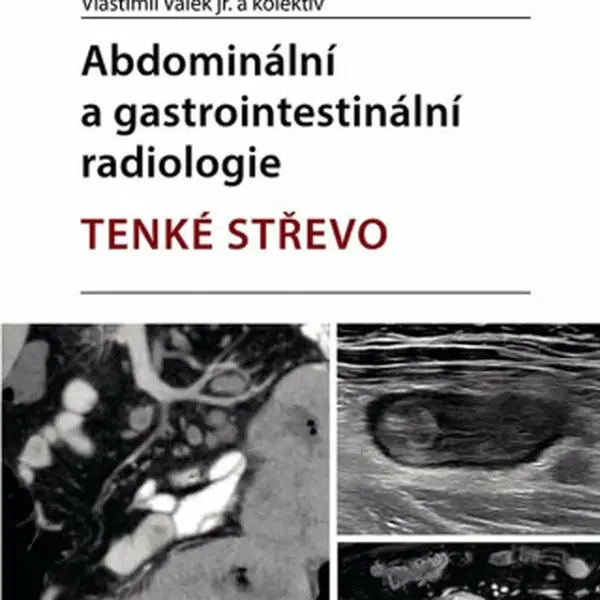 Abdominální a gastrointestinální radiologie - Tenké střevo - Vlastimil Válek