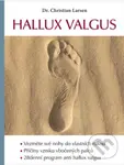 Hallux valgus - Christian Larsen