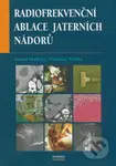 Radiofrekvenční ablace jaterních nádorů - Tomáš Skalický, Vladislav Třeška - kniha z kategorie Onkologie