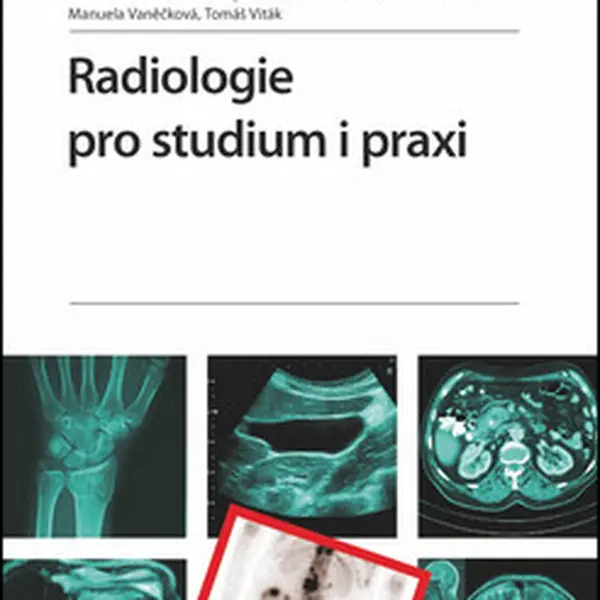 Radiologie pro studium i praxi - Zdeněk Seidl, Manuela Vaněčková, Andrea Burgetová, Eva Hoffmannová, Martin Mašek, Tomáš Viták