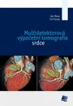 Multidetektorová výpočetní tomografie srdce - Jiří Ferda, Jan Baxa - e-kniha