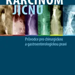 Karcinom jícnu