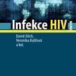 Infekce HIV