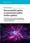 Neuromyelitis optica a onemocnění jejího širšího spektra, Nytrová Petra