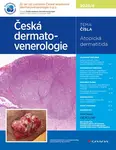 Kniha: Česká dermatovenerologie 2025/4 od