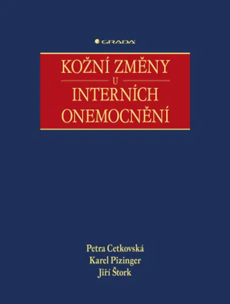 Kožní změny u interních onemocnění - Petra Cetkovská, Karel Pizinger, Jiří Štork - e-kniha