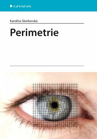 Perimetrie - Karolína Skorkovská - e-kniha