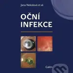 Oční infekce - Jana Nekolová - kniha z kategorie Medicína