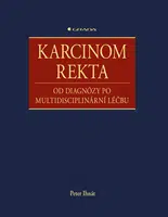 E-kniha: Karcinom rekta od Ihnát Peter