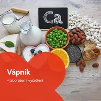 Vápník - laboratorní vyšetření