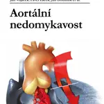 Aortální nedomykavost - Jan Vojáček, Pavel Žáček, Jan Dominik - e-kniha
