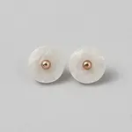 1-Hole Shank Buttons