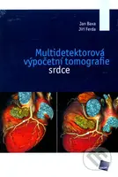 Multidetektorová výpočetní tomografie srdce - Jan Baxa, Jiří Ferda - kniha z kategorie Medicína
