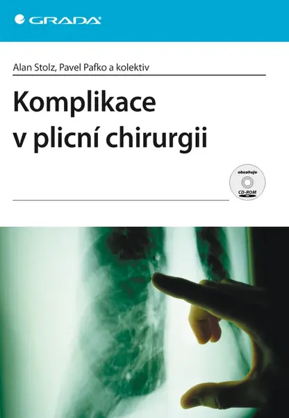 E-kniha: Komplikace v plicní chirurgii od Stolz Alan
