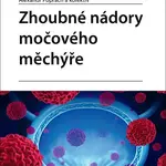 Zhoubné nádory močového měchýře