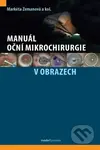 Manuál oční mikrochirurgie v obrazech - Markéta Zemanová, kolektiv autorů - kniha z kategorie Oftalmologie a otolaryngologie