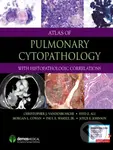 Atlas of Pulmonary Cytopathology (With Histopathologic Correlations) - kniha z kategorie Medicína