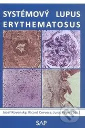 Systémový lupus erythematosus - kniha z kategorie Medicína