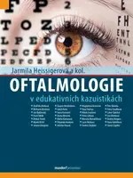 Oftalmologie v edukativních kazuistikách (Defekt) - Jarmila Heissigerová