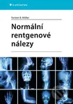 Normální rentgenové nálezy - Torsten B. Möller - kniha z kategorie Medicína