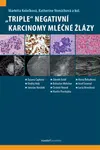 "Triple" negativní karcinomy mléčné žlázy - Markéta Kolečková