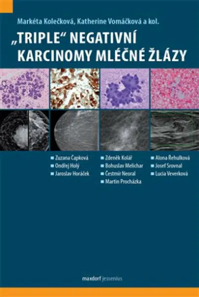 "Triple" negativní karcinomy mléčné žlázy - Markéta Kolečková