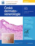E-kniha: Česká dermatovenerologie 2022/2 od Hercogová Třešňák Jana