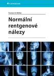 Normální rentgenové nálezy, Möller Torsten B.