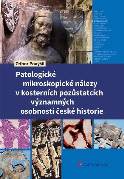 Kniha: Patologické mikroskopické nálezy v kosterních pozůstatcích významných osobností české historie od Povýšil Ctibor