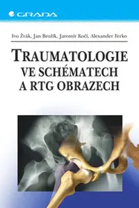 E-kniha: Traumatologie ve schématech a RTG obrazech od Žvák Ivo
