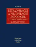 Intraoperační a perioperační endoskopie a kombinované výkony na trávicí trubici - kolektiv autorů, Ondřej Urban, Martin Stašek