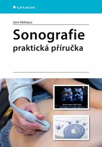 Sonografie Praktická příručka - Niehaus Jens