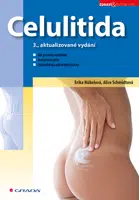 E-kniha: Celulitida od Schmidtová Alice