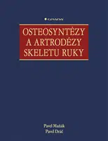 E-kniha: Osteosyntézy a artrodézy skeletu ruky od Maňák Pavel