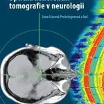 Optická koherenční tomografie v neurologii - Jana Preiningerová Lízrová - kniha z kategorie Medicína
