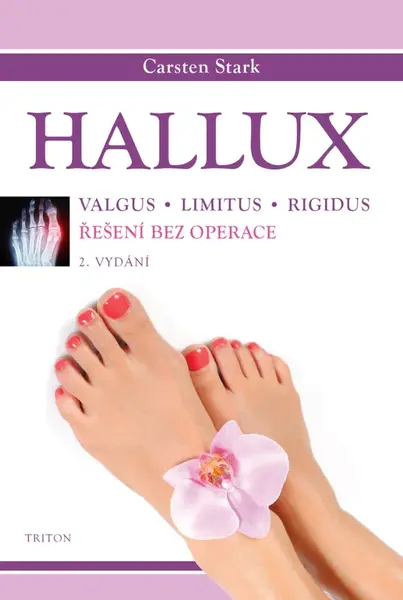 Hallux - Stark Carsten