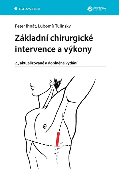 E-kniha: Základní chirurgické intervence a výkony od Ihnát Peter