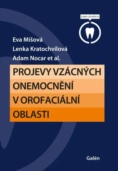 Projevy vzácných onemocnění v orofaciální oblasti - Eva Míšová, Lenka Kratochvílová, Adam Nocar