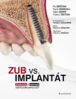 E-kniha: Zub vs. implantát od Bertani Pio
